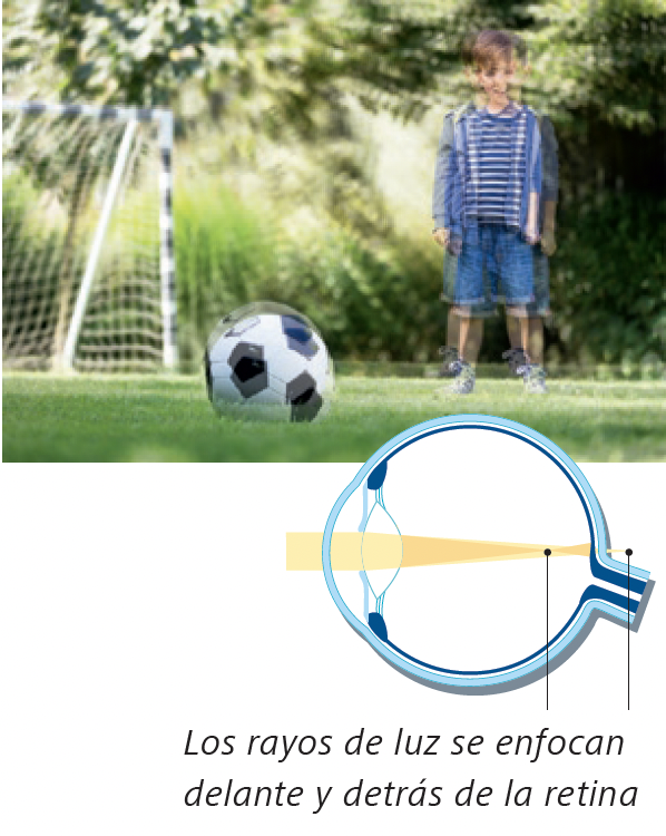 agtismatismotratamientoToledo
