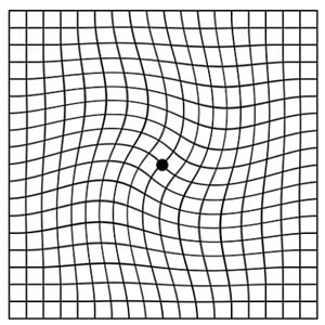 AMSLER-2