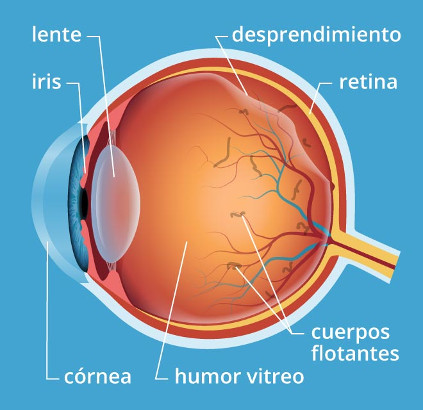 desprendimientovitreo